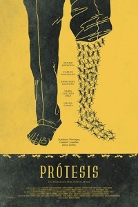  Протез 