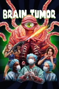  Опухоль мозга 